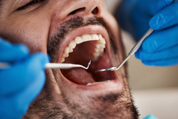Dental Inlays and Onlays in Portage, PA